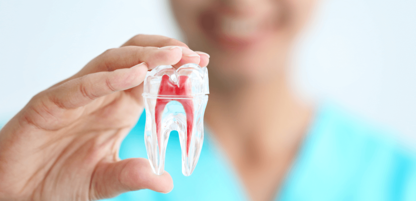 Root Canal Treatment