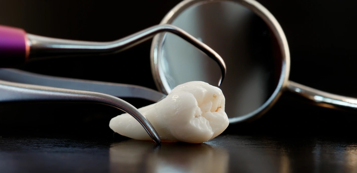 Tooth Extractions