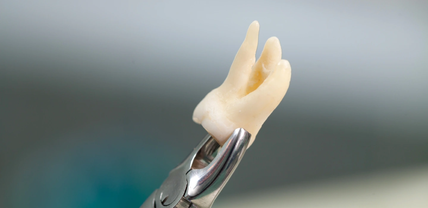 Dental Emergency